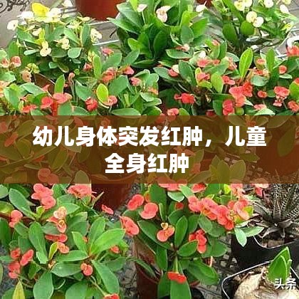 幼兒身體突發(fā)紅腫，兒童全身紅腫 