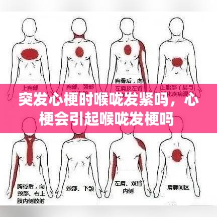突發(fā)心梗時(shí)喉嚨發(fā)緊嗎，心梗會(huì)引起喉嚨發(fā)梗嗎 