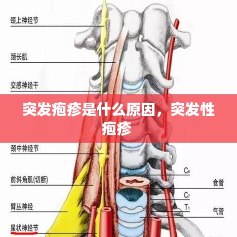 突發(fā)皰疹是什么原因，突發(fā)性皰疹 