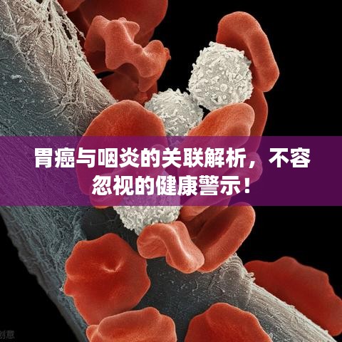 胃癌與咽炎的關(guān)聯(lián)解析，不容忽視的健康警示！