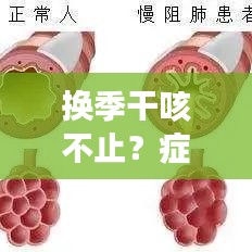 換季干咳不止？癥狀解析與應(yīng)對(duì)方案全攻略